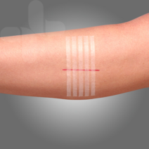 Wound Closure Strip