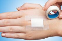 Adhesive Medical Tapes