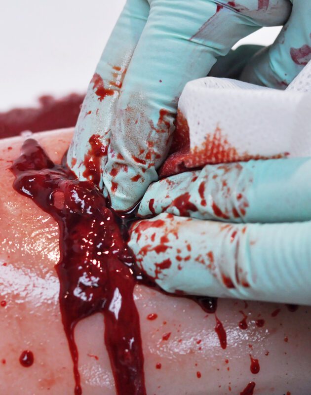 TrueClot Gauze wound packing